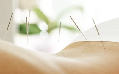 Will Acupuncture Hurt Me?